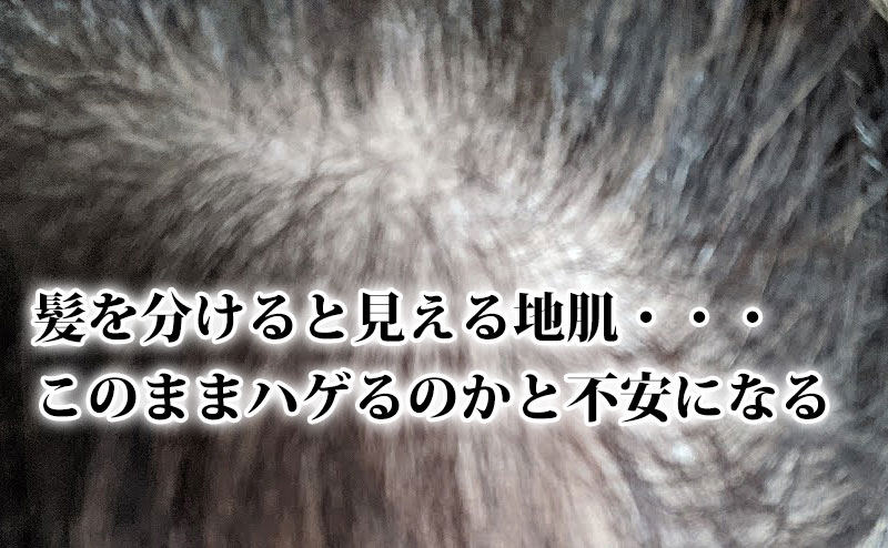 髪を分けると地肌が薄く見える